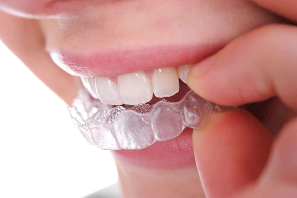 can-you-eat-with-invisalign-andover-ma