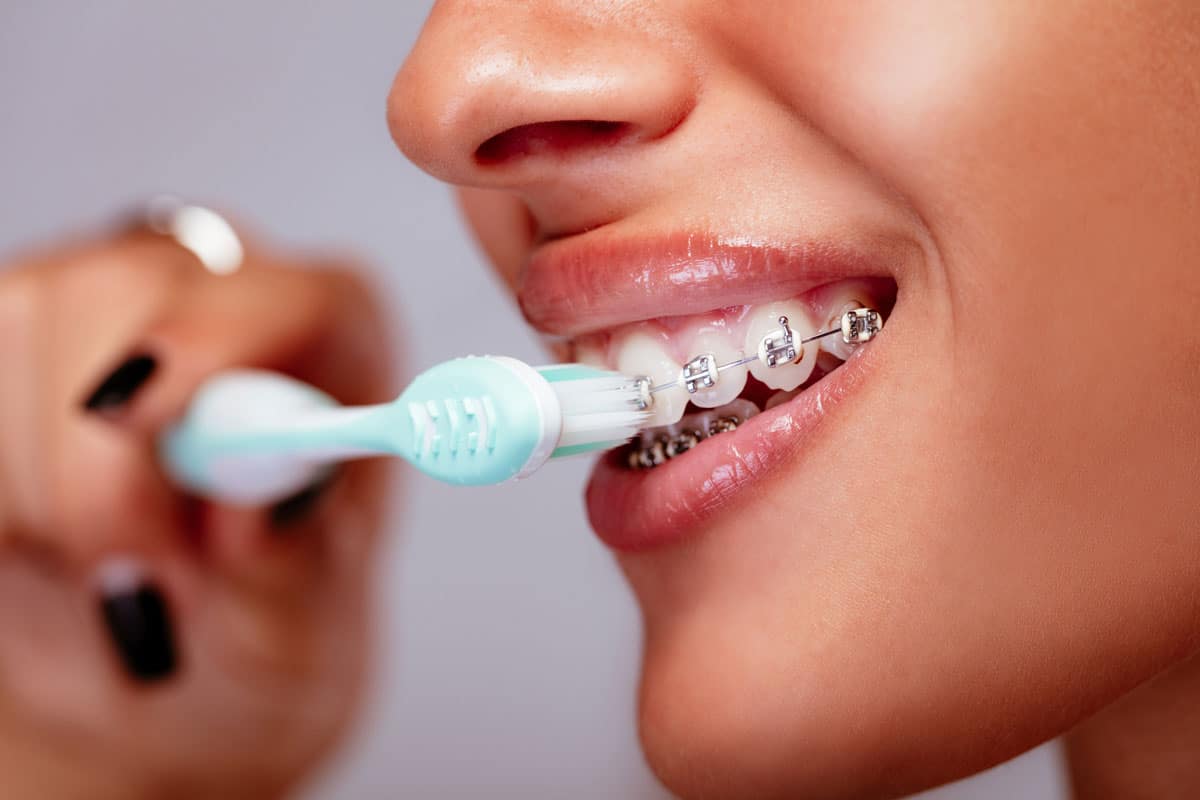 Close Up Of Woman With Braces Brushing Teeth.jpg