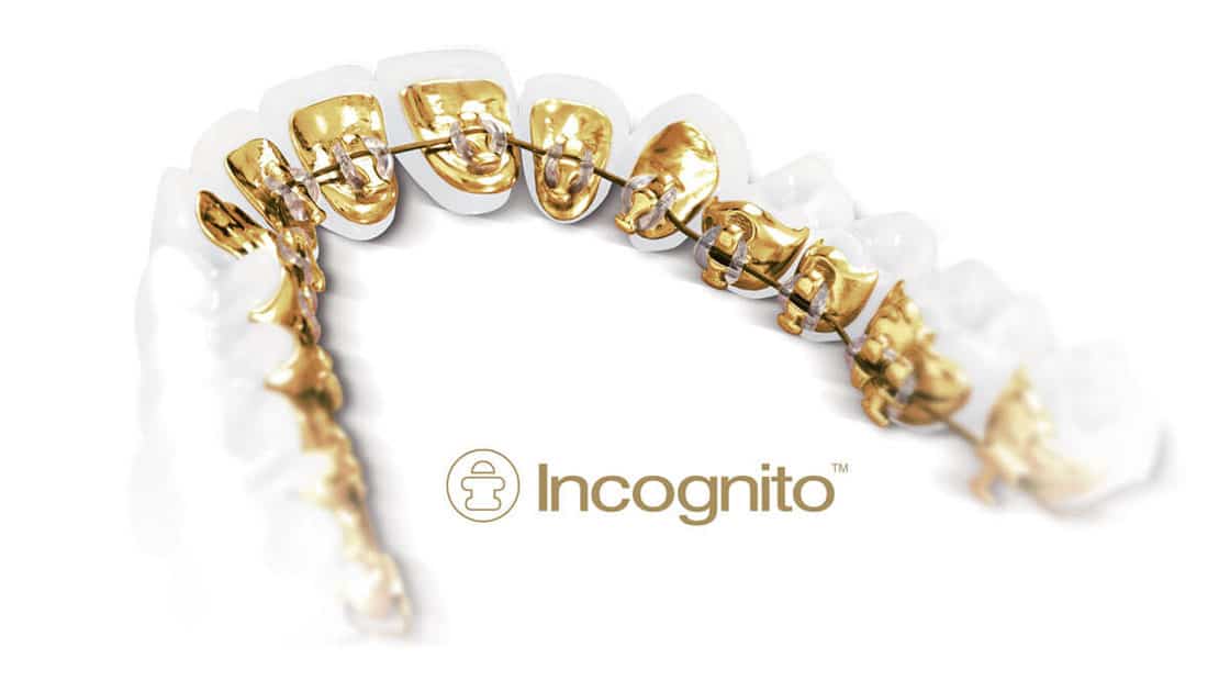 Incognito Braces 1120 Logo