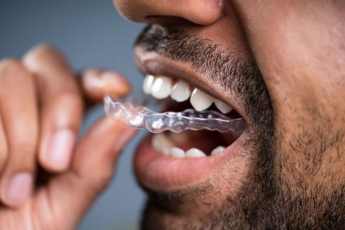 braces invisalign retainer retainers orthodontics clear should patient know
