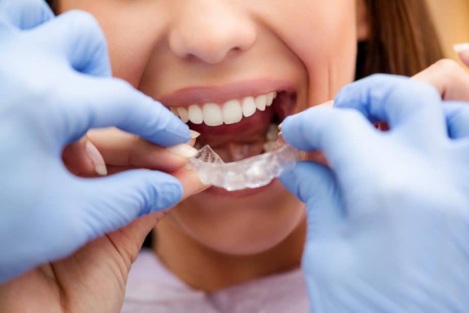 What is Invisalign and How Does it Work?